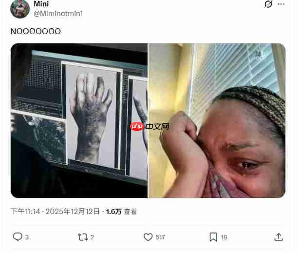 《生化危机9》惊悚细节:里昂疑似中了病毒