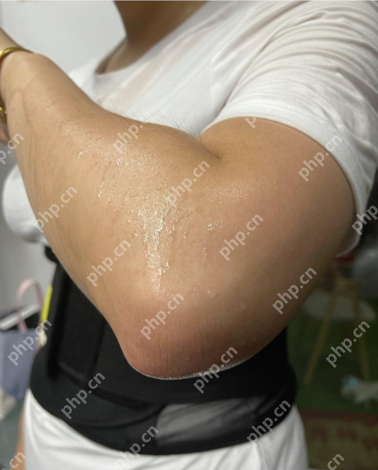 这4个常被误解的“身体缺陷”,其实是健康的标志 - php中文网