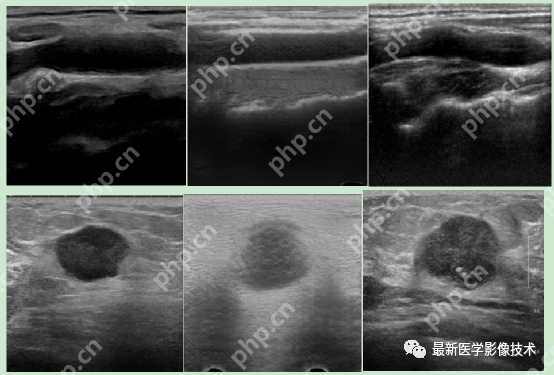 USenhance2023——2023 年超声图像增强挑战赛