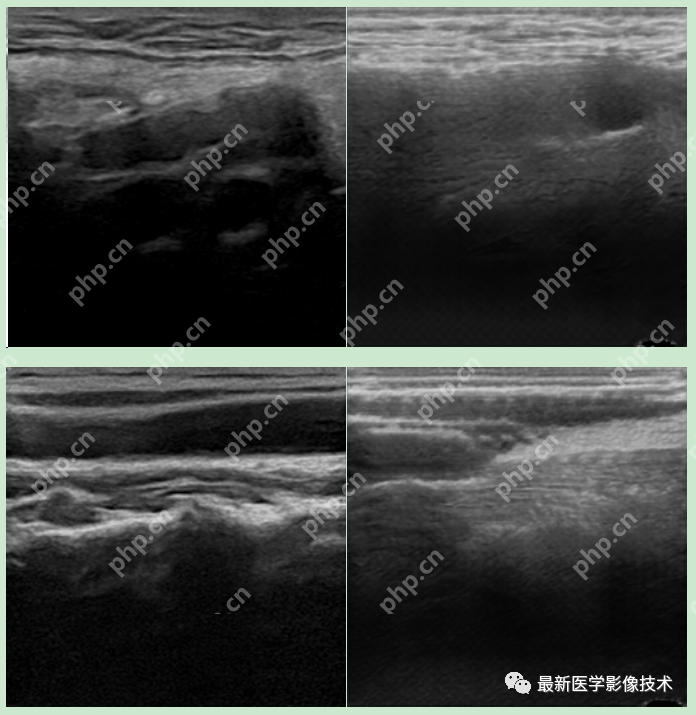 USenhance2023——2023 年超声图像增强挑战赛
