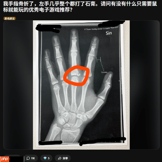 左手骨折也要打!玩家晒X光求助 网友狂推